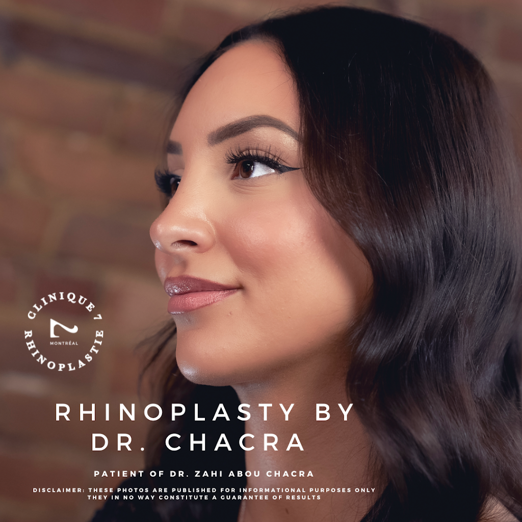 Clinique 7 - Rhinoplastie | Dr. Zahi Abou Chacra | 1310 Ave.Thérèse-Lavoie-Roux, Montréal, QC H2V 0B2, Canada | Phone: (514) 710-7017