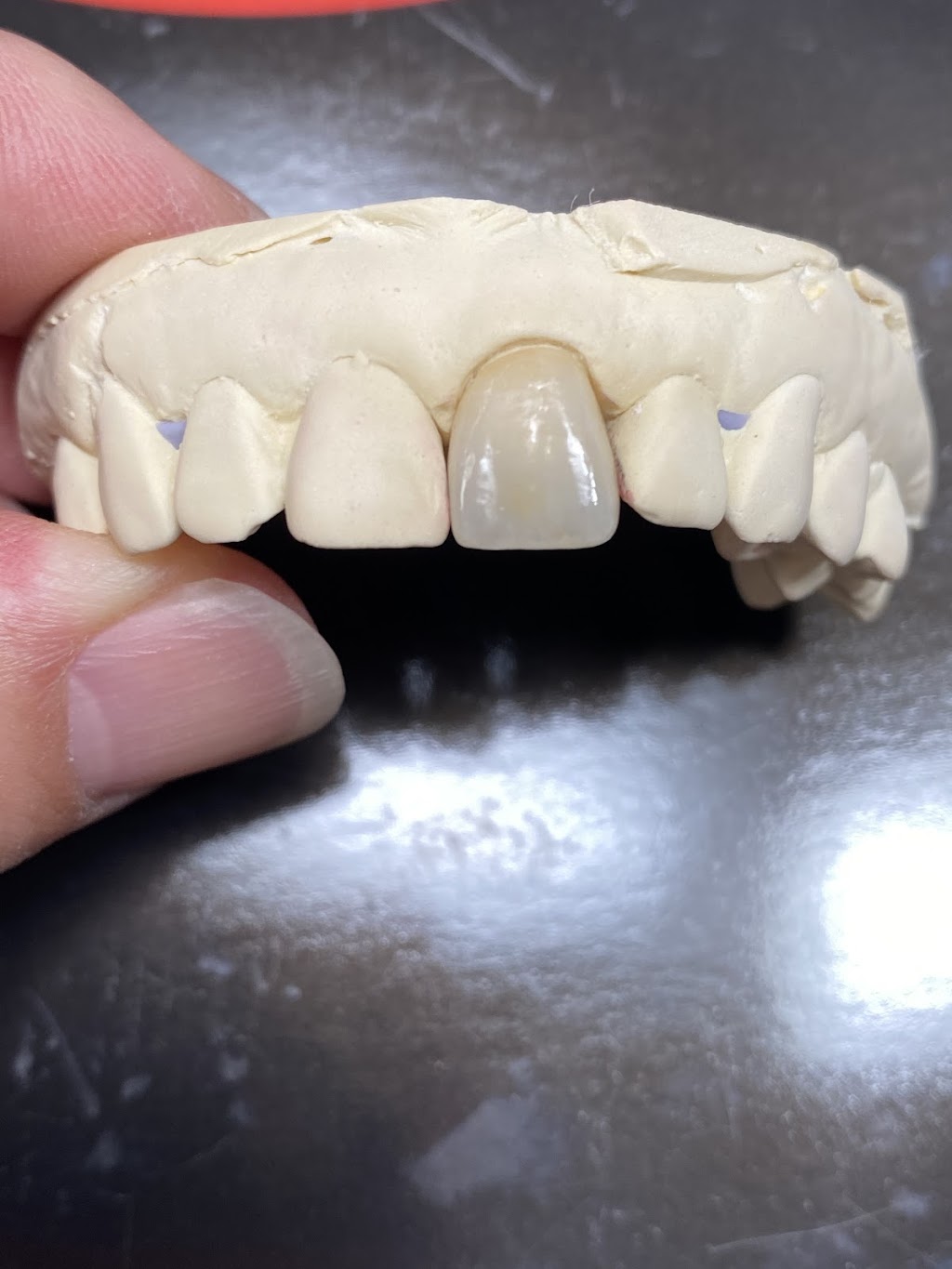 Labworks Dental Services | 10160 Ainsworth Crescent, Richmond, BC V7A 3V4, Canada | Phone: (604) 916-1875