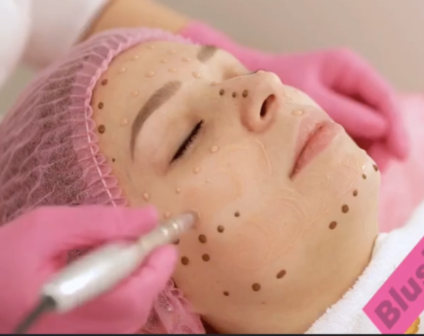 Blushes Forever Skin Care | H11C, 260300 Writing Creek Cres, Balzac, AB T4A 0X8, Canada | Phone: (825) 365-1610