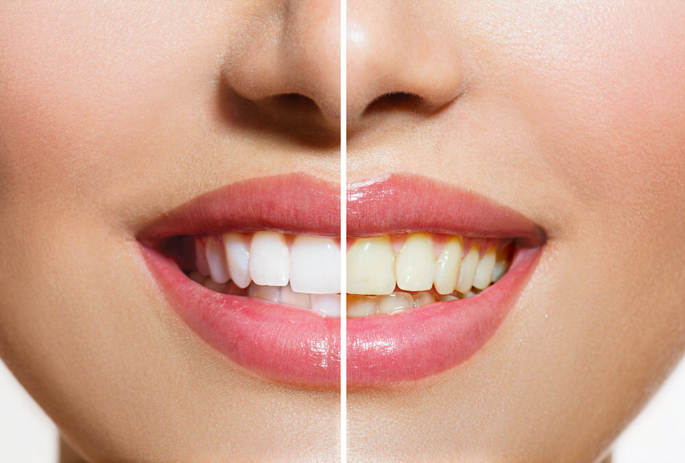Twin Dental Care | 3737 Major MacKenzie Dr W, Woodbridge, ON L4H 0A2, Canada | Phone: (226) 778-7432