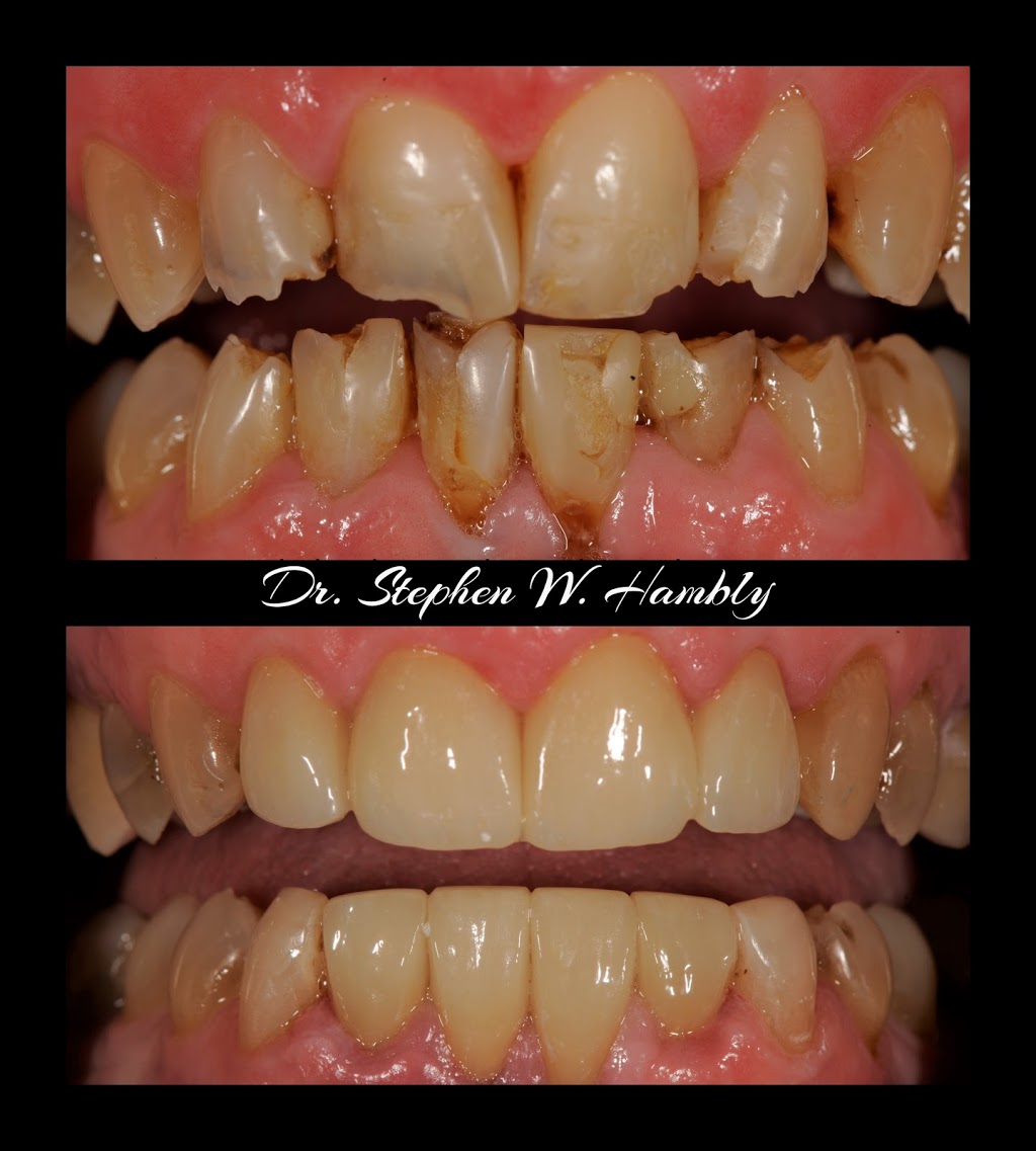 Ancaster Dental Care | 34 Stone Church Rd Suite 202, Ancaster, ON L9K 1S5, Canada | Phone: (905) 304-3479