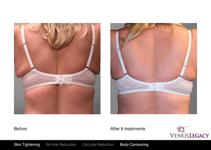 Enhanced by Milo | Classic Dr, London, ON N5W 5T9, Canada | Phone: (519) 619-9229