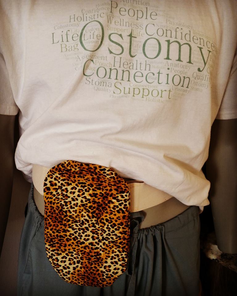Ostomy Connection | 7 Main St W, Norwich, ON N0J 1P0, Canada | Phone: (519) 200-7031