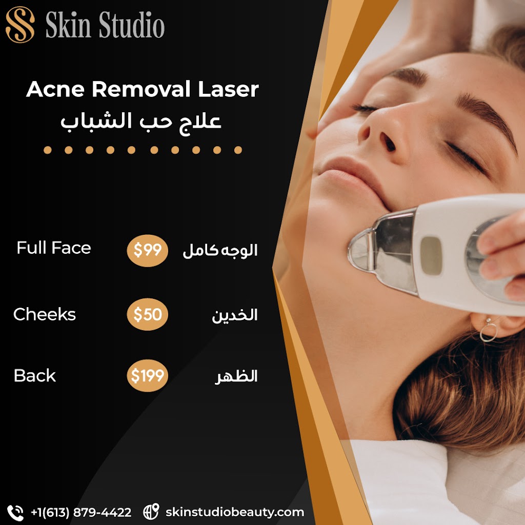 Skin Studio Beauty - Shrein | 265 Gracewood Crescent, Gloucester, ON K1T 0J1, Canada | Phone: (613) 879-4422