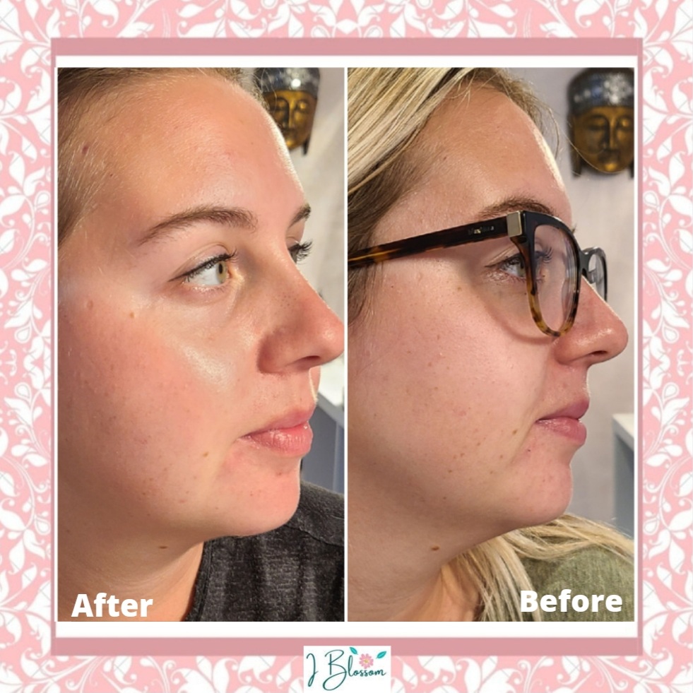 I Blossom Skincare | 119 Nash Rd S, Hamilton, ON L8K 4J8, Canada | Phone: (519) 321-0897