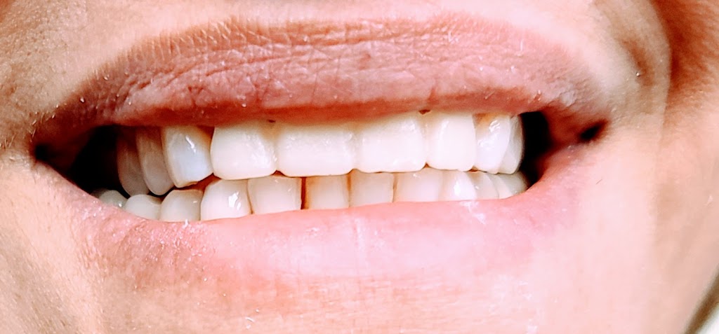 Mountain View Smiles | 208 10th Ave Unit 2, Carstairs, AB T0M 0N0, Canada | Phone: (825) 509-2588