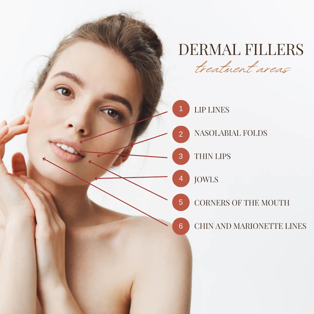 Lets Face It by Cindy | Botox | Dermal Fillers | 65 Joy Ct, Corbyville, ON K0K 1V0, Canada | Phone: (613) 779-7266