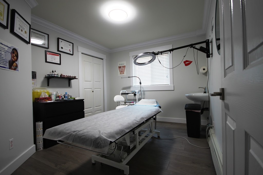 Dermatec Permanent Cosmetic and Laser Clinic | 6499 122a St, Surrey, BC V3W 3R8, Canada | Phone: (604) 805-4273