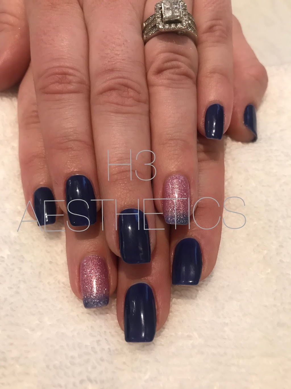 H3 Aesthetics | 4 Park Ave W, Elmira, ON N3B 1L2, Canada | Phone: (519) 835-2686
