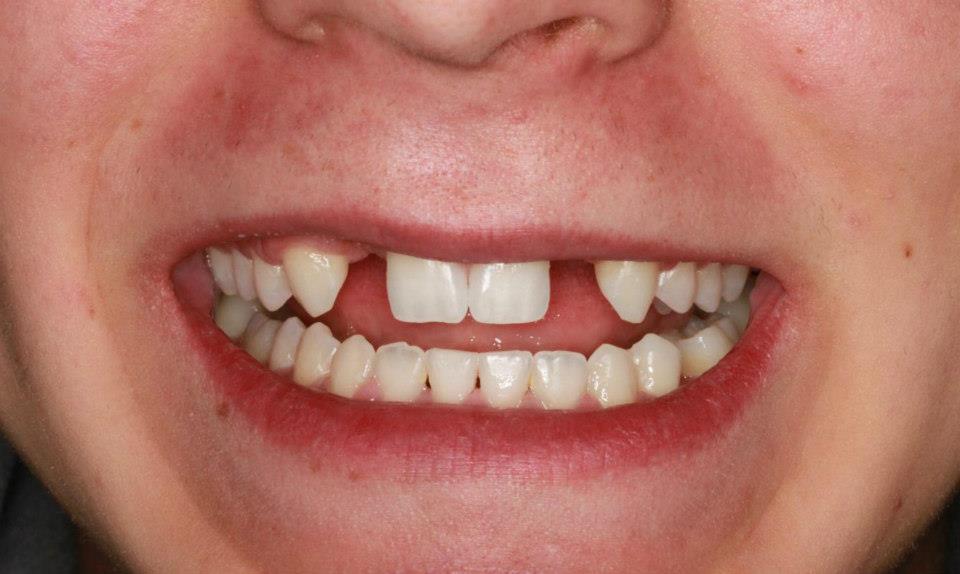J169 Dental Design Inc | 181 Sablewood Rd, Winnipeg, MB R3Y 0H8, Canada | Phone: (204) 417-2924