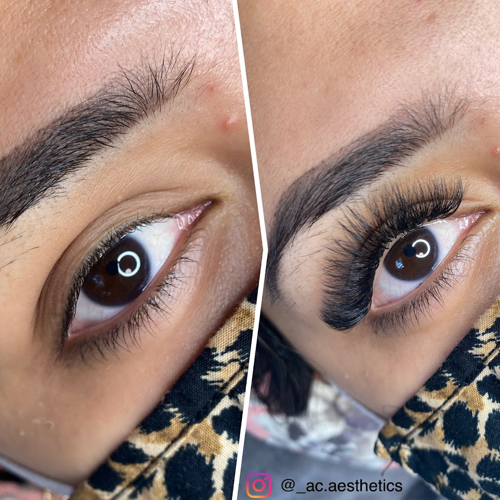 Angela Carley - AC Aesthetics | 2831 McCrimmon Dr, Abbotsford, BC V2S 2V1, Canada | Phone: (778) 201-7877