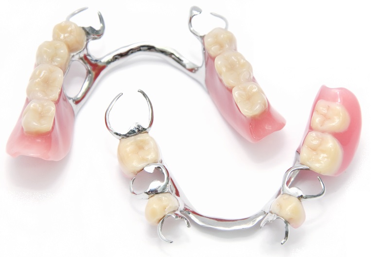 Denture & Dental Hygiene Clinic | 647 McCowan Rd, Scarborough, ON M1J 1K2, Canada | Phone: (416) 900-1894