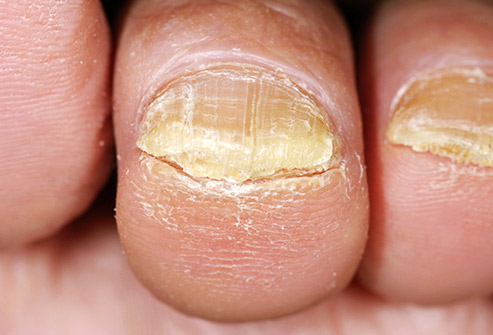 Sole Solutions Foot Care | 44 Deboer Dr, Lawrencetown, NS B0S 1M0, Canada | Phone: (902) 840-1783