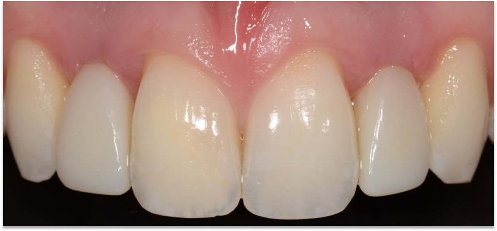 Dr Philippe Girard Prosthodontiste | 1145 Boulevard Lebourgneuf #100, Québec, QC G2K 2K8, Canada | Phone: (418) 624-7333