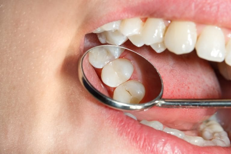 Dental Studio - Front Street (formerly Front Street Dental) | 311 Ontario St Suite 1, Stratford, ON N5A 3H6, Canada | Phone: (226) 455-7448