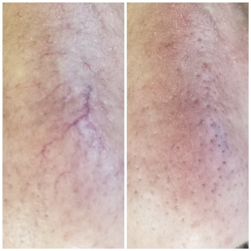Skin Essentials Laser Clinic | 58 Cathedral High St, Markham, ON L6C 0P3, Canada | Phone: (416) 843-7458