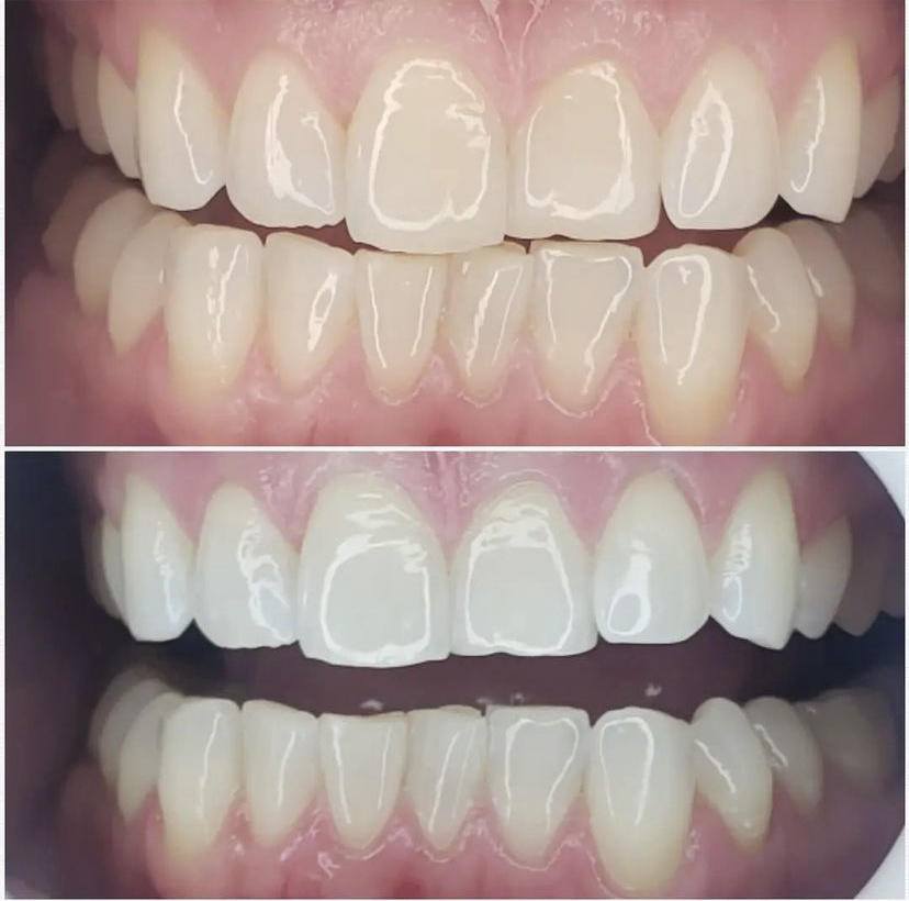 Customized Glow | 168 Angeline St N, Lindsay, ON K9V 4X2, Canada | Phone: (416) 726-6321