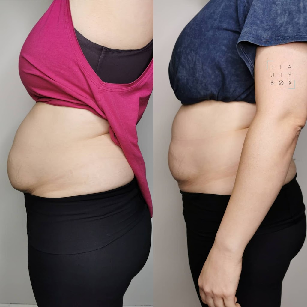 Beauty Box | 22 Second St Suite 201, Collingwood, ON L9Y 1E3, Canada | Phone: (705) 994-3811
