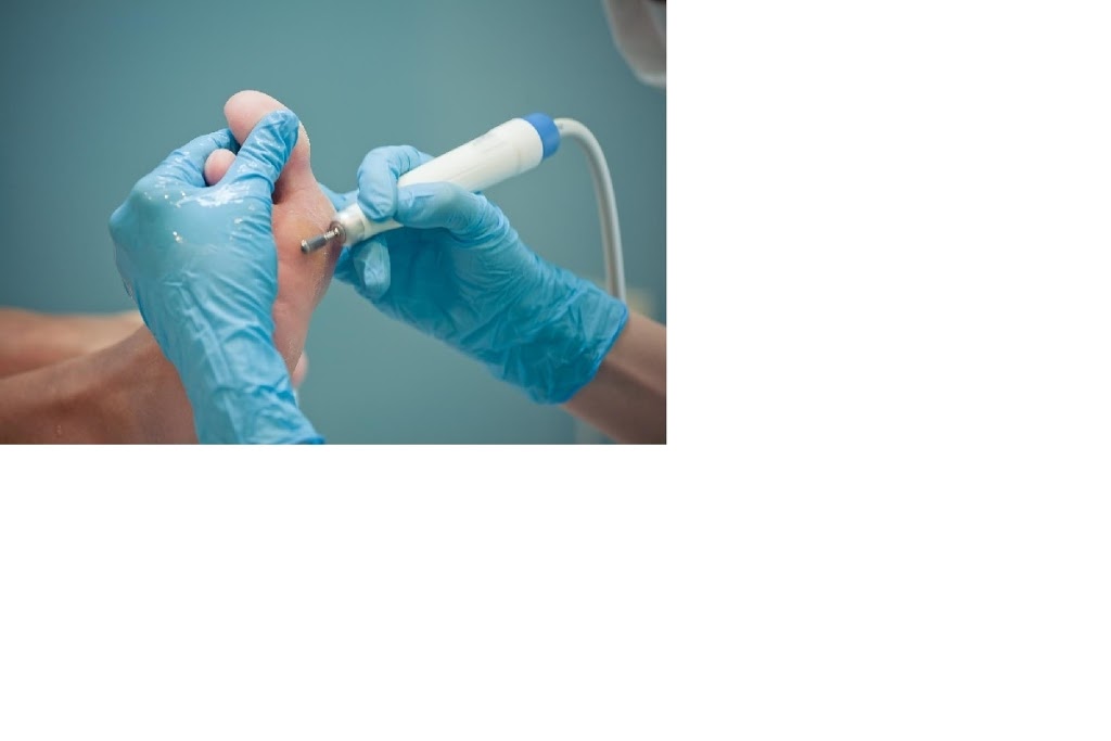 The Foot Nurse | 317 Detroit Line, Wheatley, ON N0P 2P0, Canada | Phone: (519) 990-7308