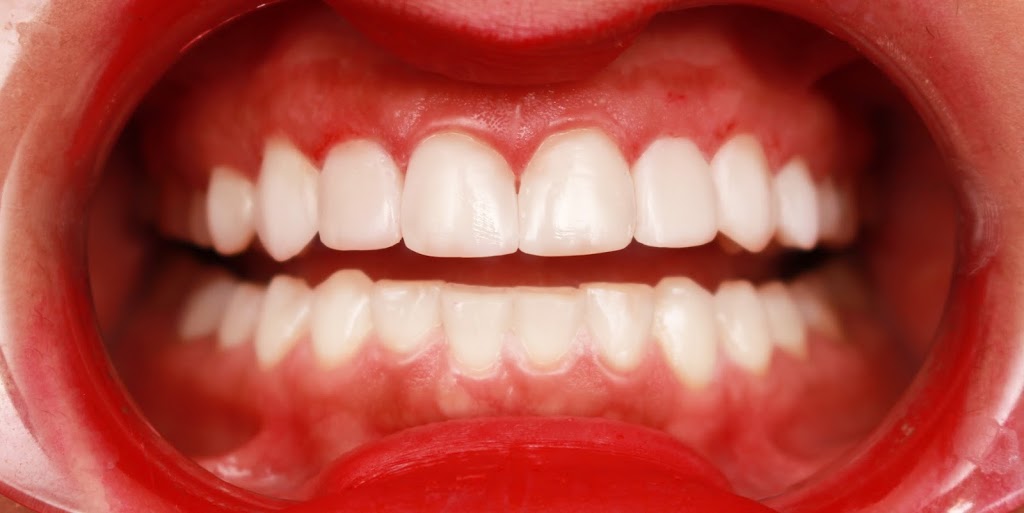 Trillium Smile Dentistry | 2000 Credit Valley Rd #112, Mississauga, ON L5M 4N4, Canada | Phone: (905) 828-9894