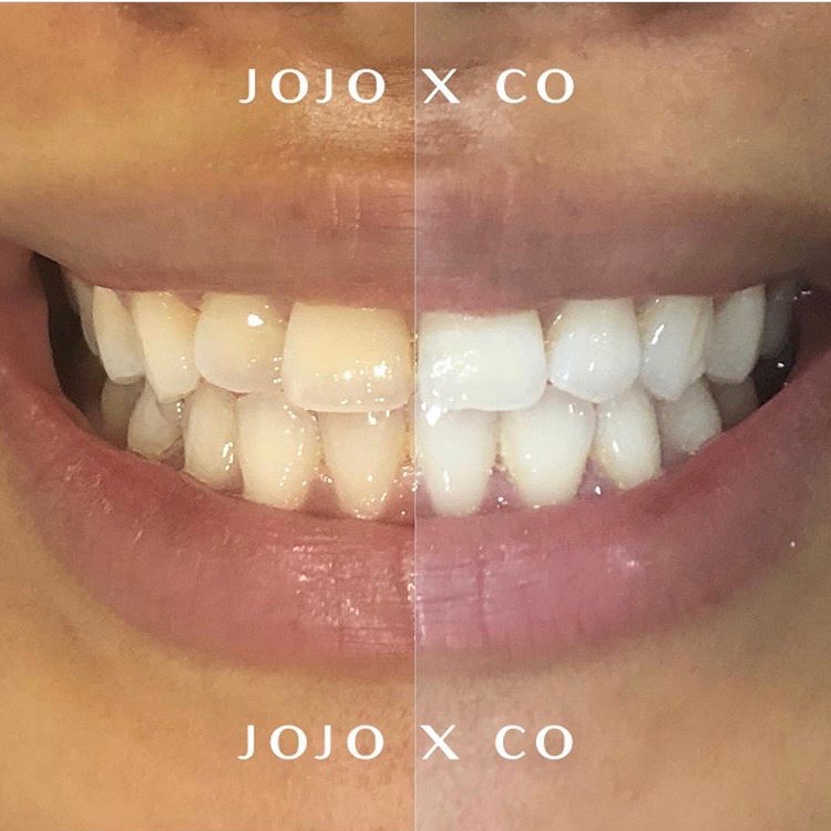 Jojo x Co Beauty | 1850 Eglinton Ave W, York, ON M6E 2J4, Canada | Phone: (647) 931-9788