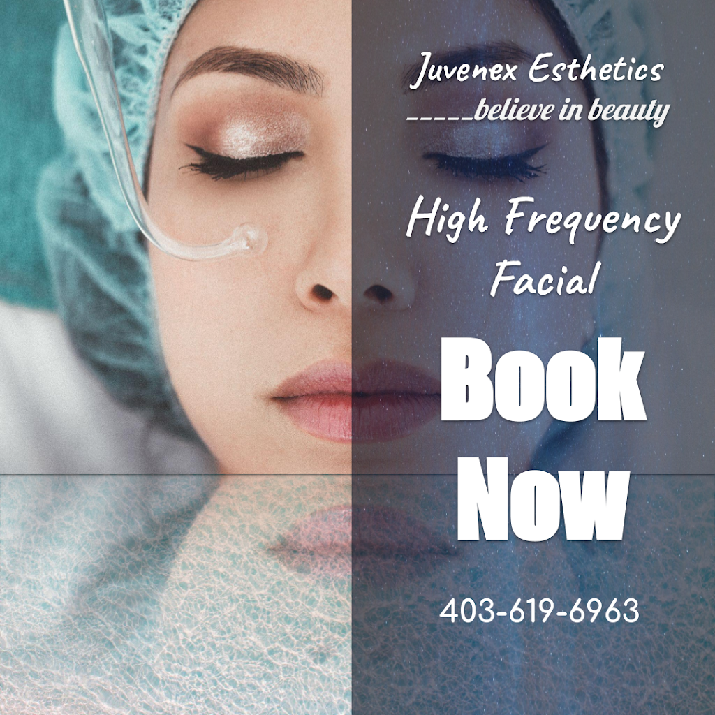 Juvenex Esthetics Evanston | Evansfield Cl NW, Calgary, AB T3P 1V6, Canada | Phone: (403) 619-6963
