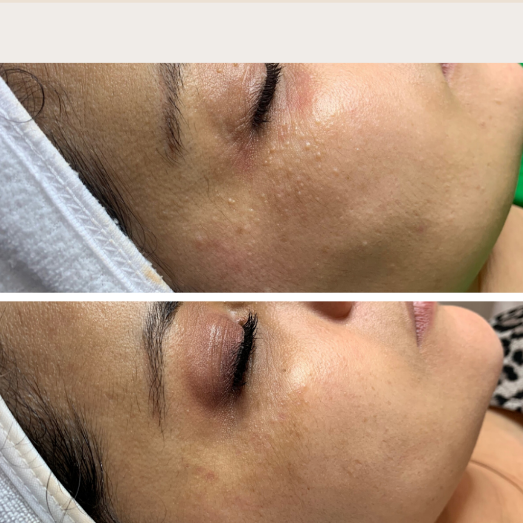 Clinique Peaufiné - Esthétique & Laser | 50 Chem. de la Carrière, Carignan, QC 106, Canada | Phone: (450) 876-0401