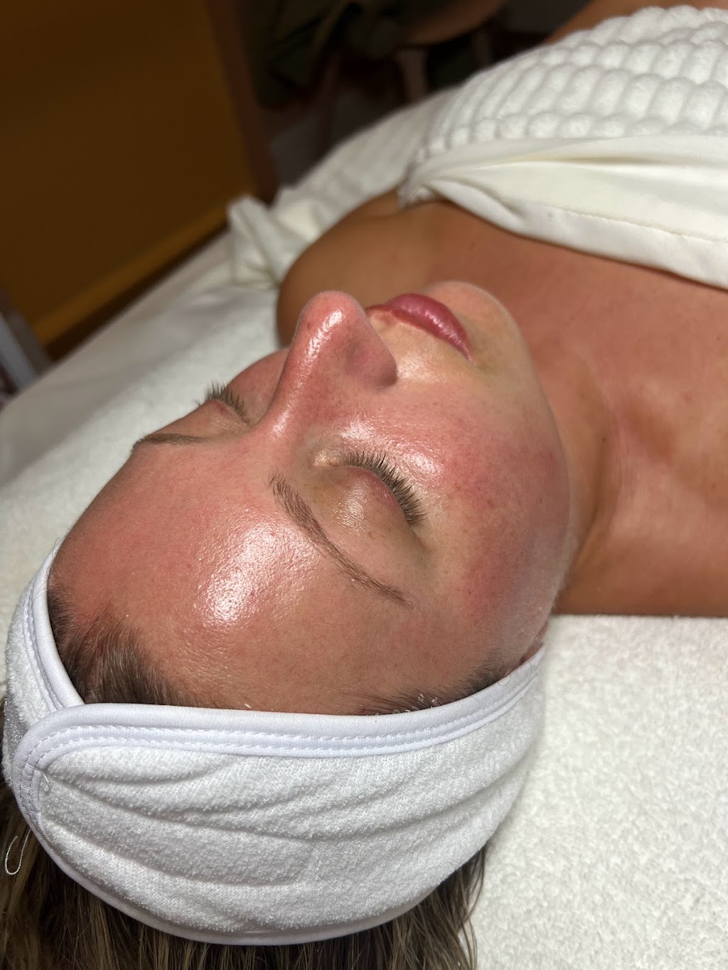 ah esthetics | 1002 King St E, Hamilton, ON L8M 1C8, Canada | Phone: (519) 771-8088