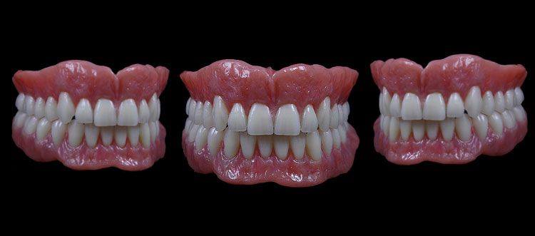 The Denture Center | 2892 S Sheridan Way, Oakville, ON L6J 7L4, Canada | Phone: (905) 829-1033