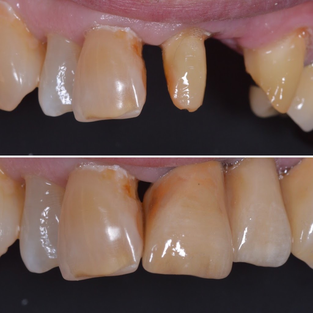 Chois Dental Studio | 1270 King St E, Cambridge, ON N3H 3P8, Canada | Phone: (289) 788-3996