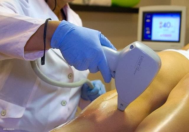 Pura laser | 681 Rue Adoncour, Longueuil, QC J4G 2M6, Canada | Phone: (514) 705-4923