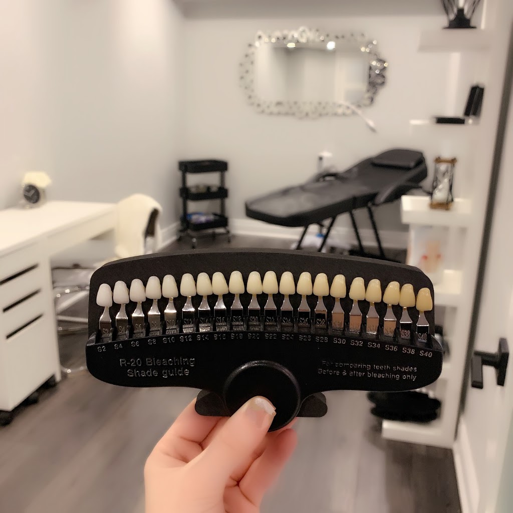 House of Smiles Teeth Whitening Inc. | 442 Lockmaster Crescent, Manotick, ON K4M 1L9, Canada | Phone: (613) 620-3504