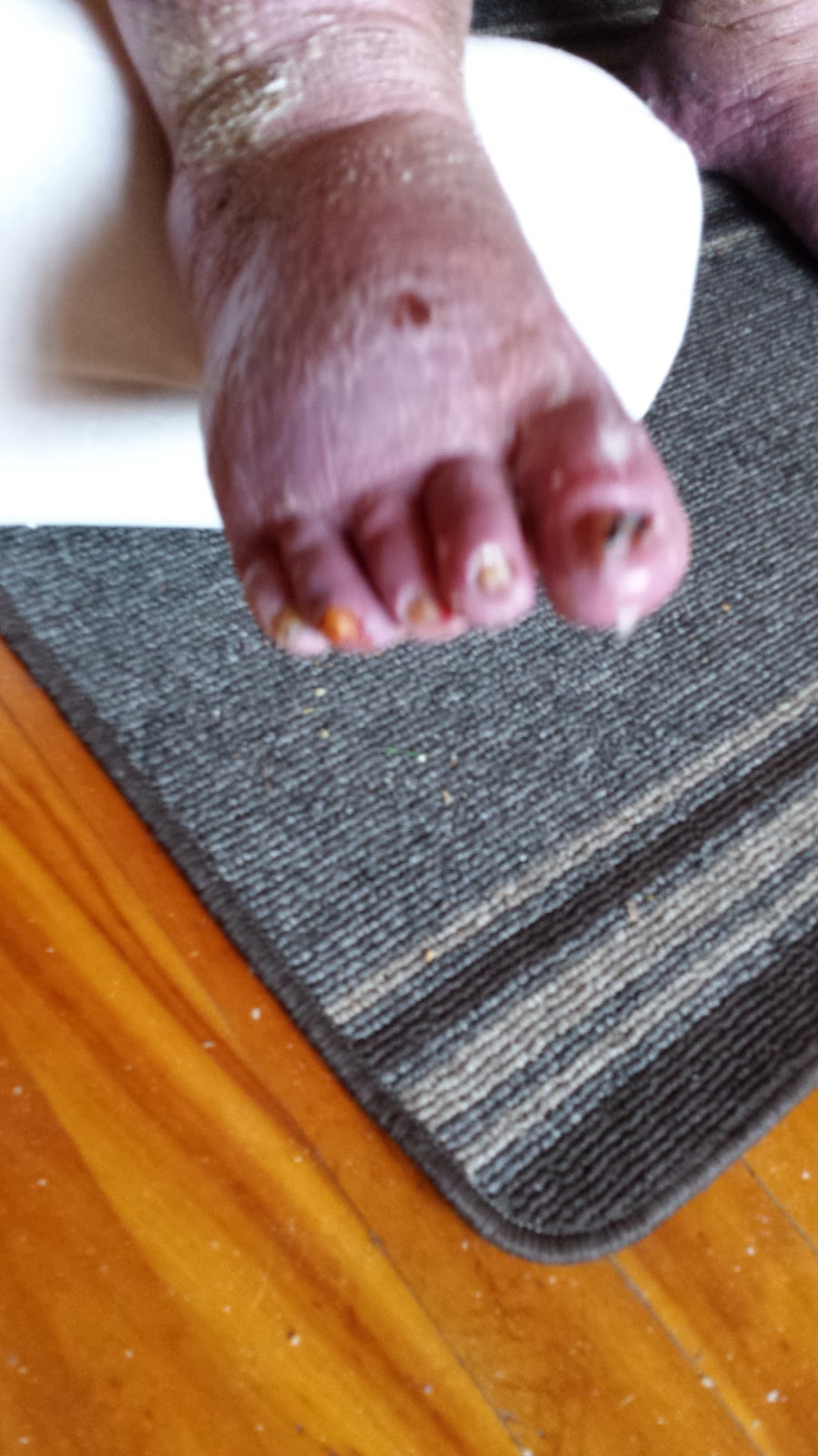 Chantal Gagnier : infirmière en soins de pieds | 12081 Avenue Desaulniers, Montréal-Nord, QC H1G 5J9, Canada | Phone: (514) 755-8082