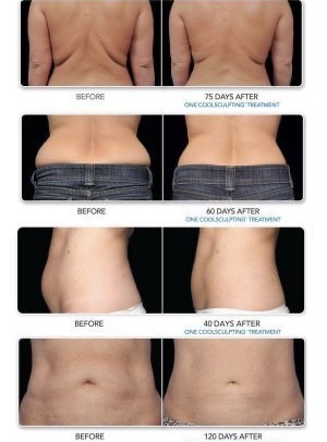 Pure Beauty by Peggy | 23 Cimarron Estates Link, Okotoks, AB T1S 0C6, Canada | Phone: (403) 504-7163