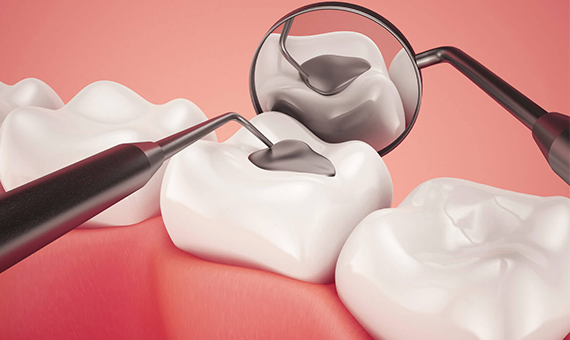 Dr Amanpreet Chopra Dentistry | 7990 Kennedy Rd S, Brampton, ON L6W 0A2, Canada | Phone: (905) 455-5200