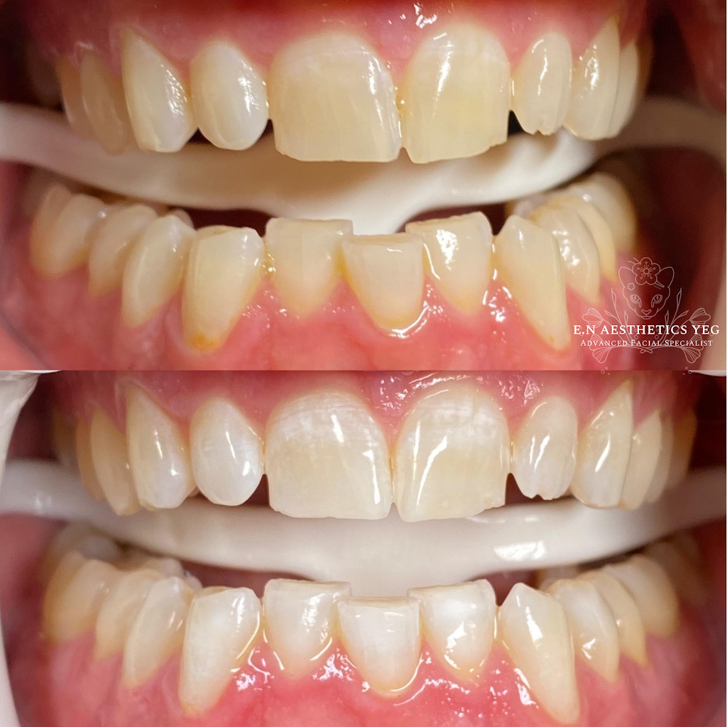 Lunar Medical Aesthetics | 31 Kingsbury Cir, Spruce Grove, AB T7X 0C9, Canada | Phone: (780) 920-9981
