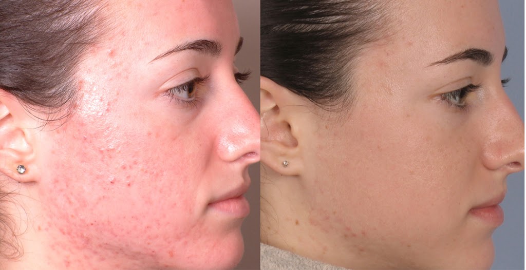 Beautique Laser Spa | 398 Steeles Ave W Unit #3, Thornhill, ON L4J 6X3, Canada | Phone: (416) 877-4348