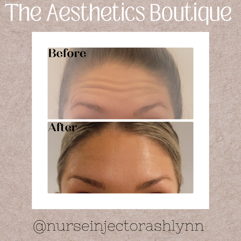 The Aesthetics Boutique | 64 Viking Dr, Binbrook, ON L0R 1C0, Canada | Phone: (289) 921-8240