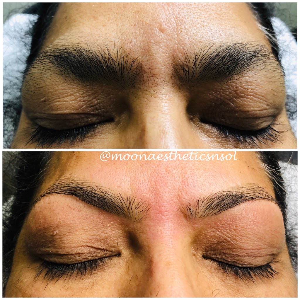 Moon Aesthetics n Solutions | 159 Shephard Ave, Alliston, ON L9R 0J8, Canada | Phone: (705) 718-1836