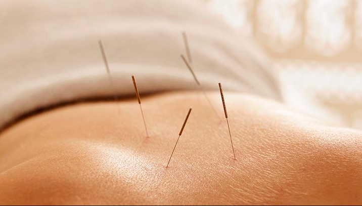 John & Jenny TCM Clinic Centre | 8791 Woodbine Ave #100, Markham, ON L3R 0P4, Canada | Phone: (905) 604-7298