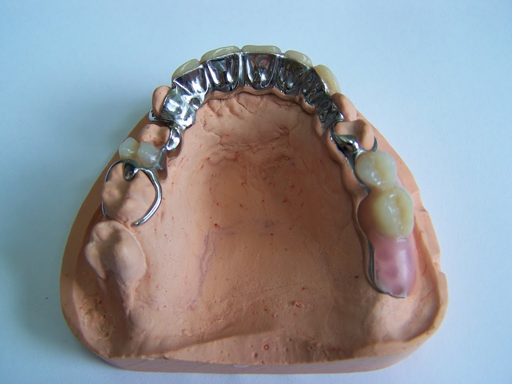 Centre de Denturologie Ranger et Associés. | 2424 Boul. Lapinière, Brossard, QC J4Z 2K9, Canada | Phone: (450) 465-9111