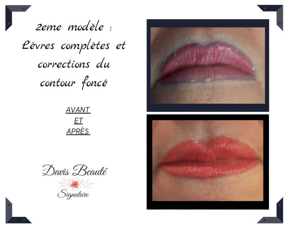Davis Beauté Signature | 1420 Boulevard Rome, Brossard, QC J4W 2T4, Canada | Phone: (514) 792-5225