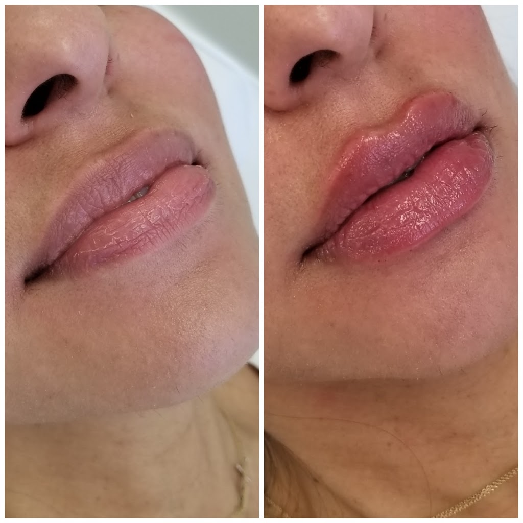 S.M.L.L Skin Solutions | 1092 Islington Ave Unit #201, Etobicoke, ON M8Z 4R9, Canada | Phone: (416) 417-2516