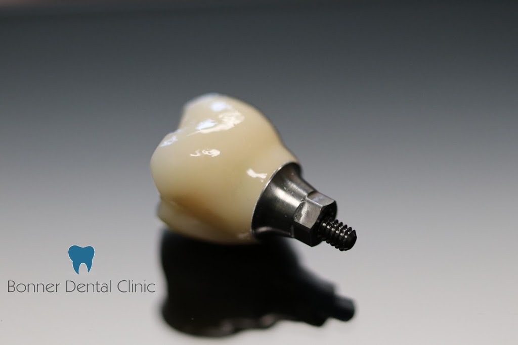 Bonner Dental Clinic | 591 Rothesay Ave, Saint John, NB E2H 2G9, Canada | Phone: (506) 633-1086