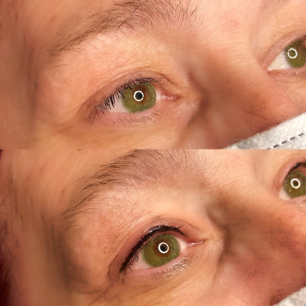 Diamond J Esthetics | Airdrie, AB T4B 0G9, Canada | Phone: (403) 465-0817