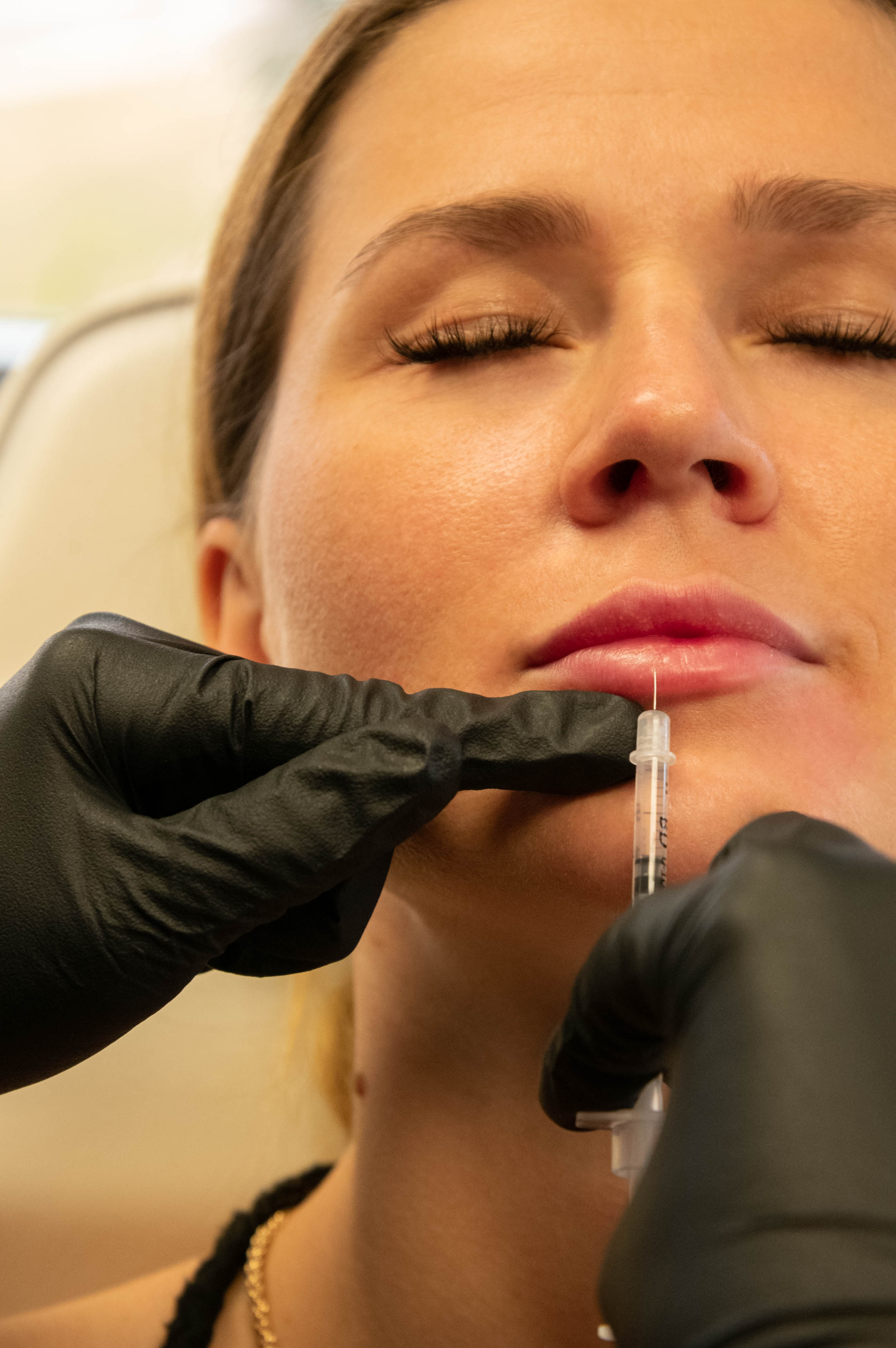 Springbank Skin Centre | 7460 Springbank Blvd SW #230, Calgary, AB T3H 5P7, Canada | Phone: (403) 613-7464