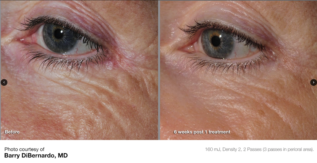 Profile Medical Cosmetics | 1415 1st Ave W Suite #3004, Owen Sound, ON N4K 4K8, Canada | Phone: (519) 270-0833