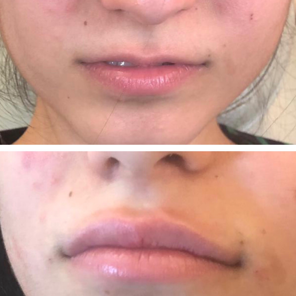 Ageless Medical Cosmetic Clinic | 1100 Dundas St W unit 1, Mississauga, ON L5C 4E7, Canada | Phone: (647) 951-5392