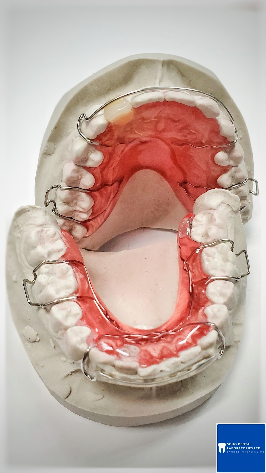 Soho Dental Laboratories Ltd | 4008 Deane Pl, North Vancouver, BC V7G 2P3, Canada | Phone: (604) 722-4855