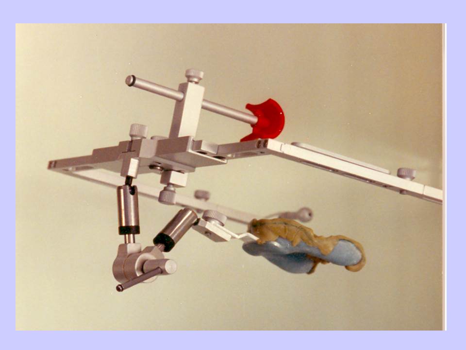 Implant Restorations Inc | 661 Sandford Rd, Uxbridge, ON L9P 1R2, Canada | Phone: (866) 802-3623